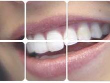 sorriso
